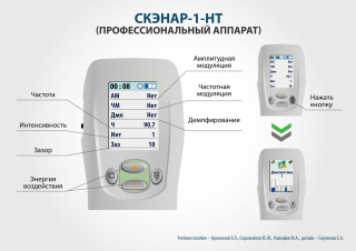 СКЭНАР-1-НТ (исполнение 01)  в Сосновом Бор купить Скэнар официальный сайт - denasvertebra.ru 